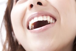銀歯でなくて 白い詰め物 かぶせものにしたい 八潮の歯医者なら子どもが楽しい歯医者さんlealea歯科矯正歯科クリニック