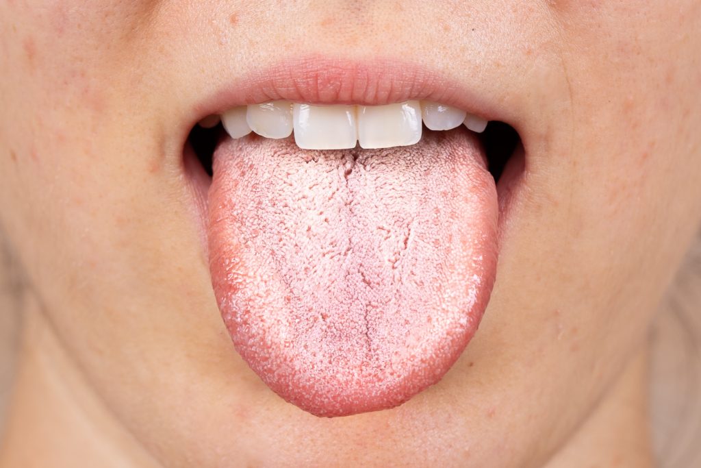 が ピリピリ する 舌 舌のピリピリ感と コロナウイルスの関係性