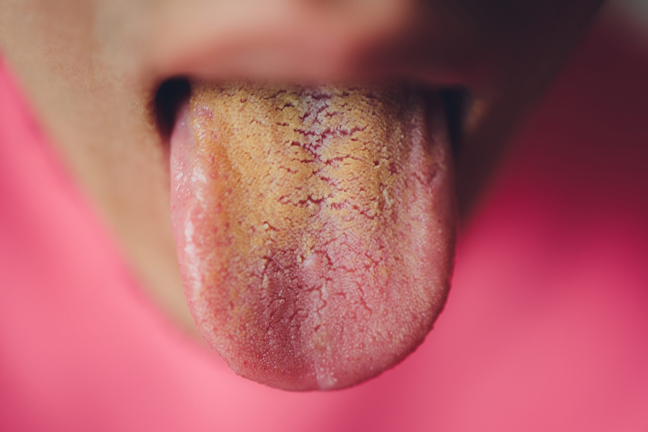 効果 舌 磨き 舌磨きをする効果ってどんなもの？正しい舌磨きの方法とは！？｜feely(フィーリー)